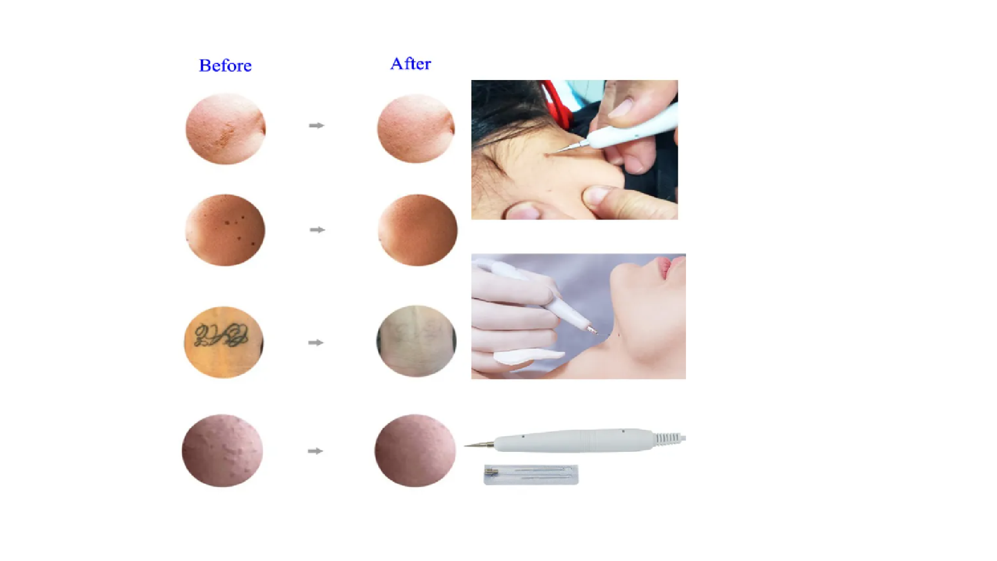 Máquina de vacío Utrasónica, Multifuncional 8 en 1, Masajeador Facial Galvánico