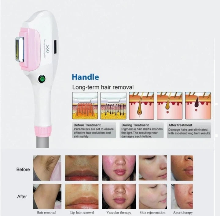 IPL 360 - IE-