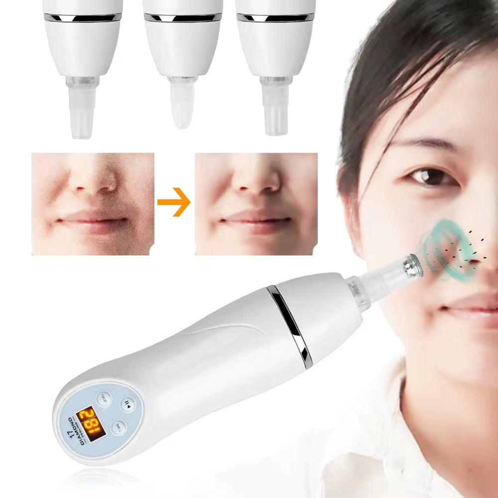 Diamond Peeling Dermabrasion Skin Peeling Digital
