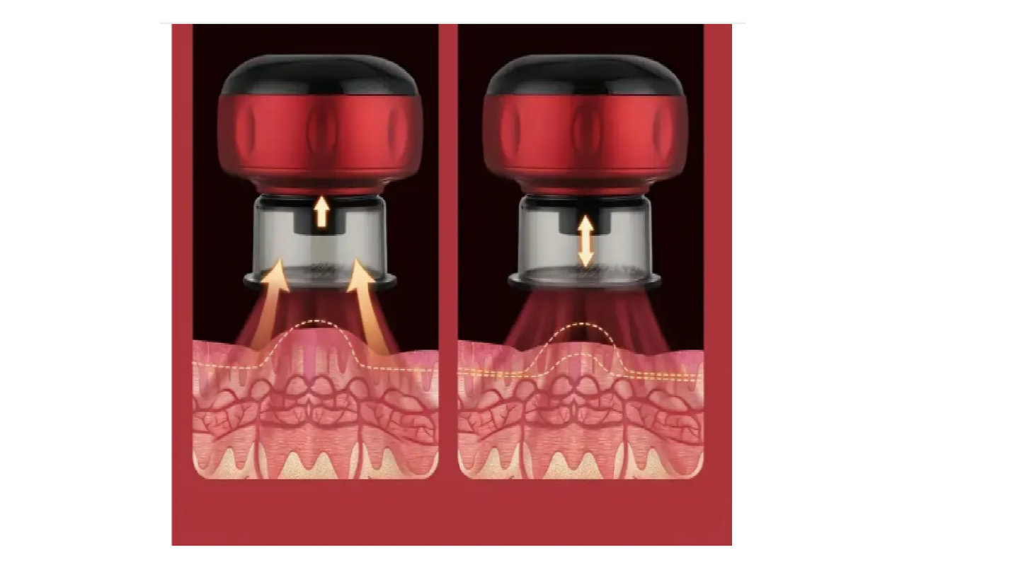 Electric Cupping- Color Red