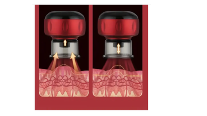 Electric Cupping- Color Red