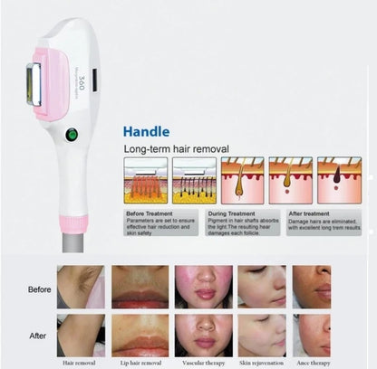 IPL 360 - IE-