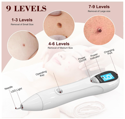 NEVUS PEN- MOLE REMOVAL - FIBROBLAST