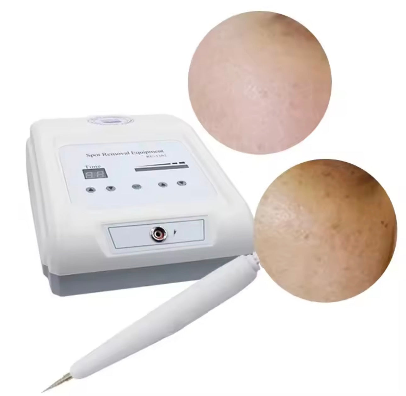 Portable High-frequency Ultrasound