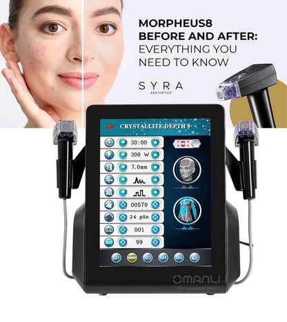 MORPHEUS 8