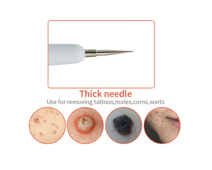 Electric Cautery Spot Removal Machine